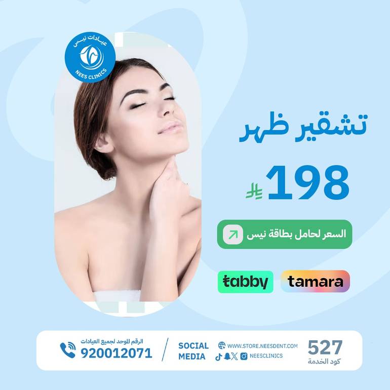 تشقير ظهر