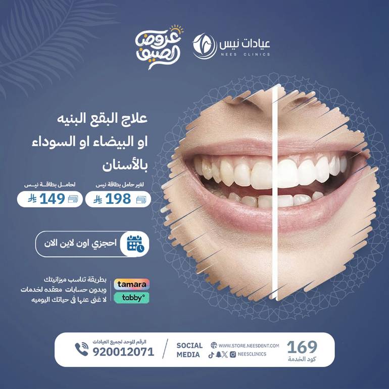 علاج البقع البنيه او البيضاء او السوداء بالاسنان