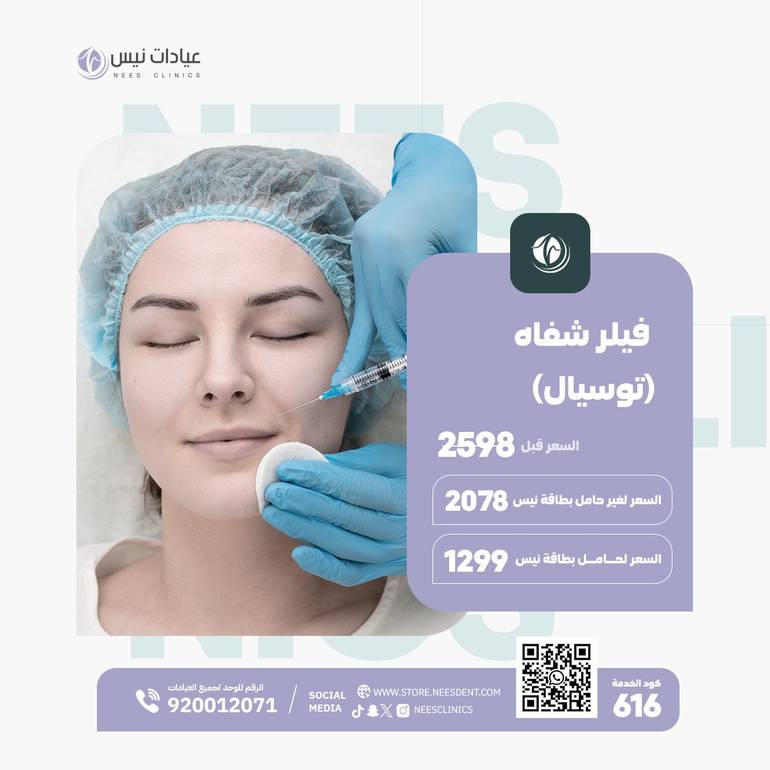 فيلر شفاه (توسيال)