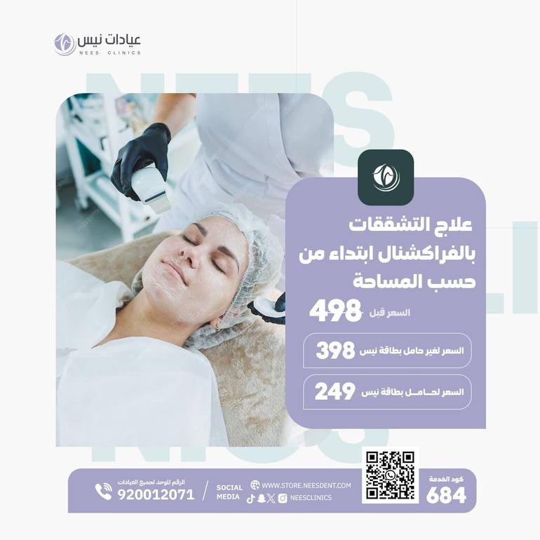 علاج التشققات بالفراكشنال (ابتداء من.... حسب المساحة)