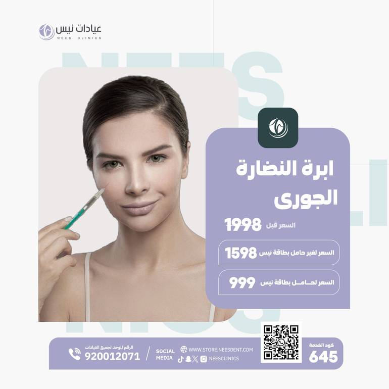 ابرة النضارة الجورى
