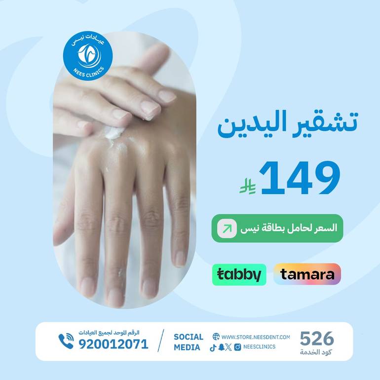 تشقير اليدين