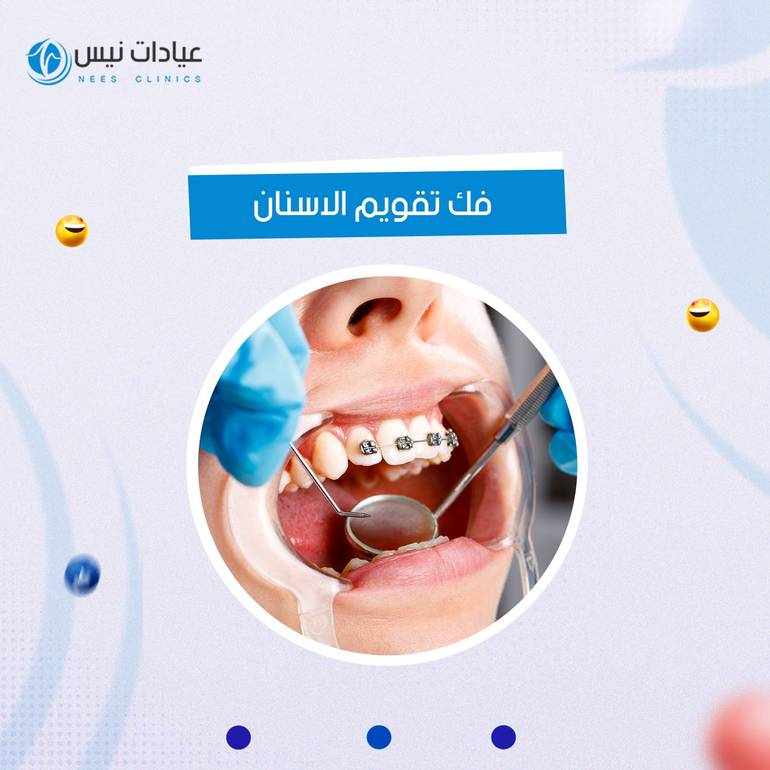 فك التقويم