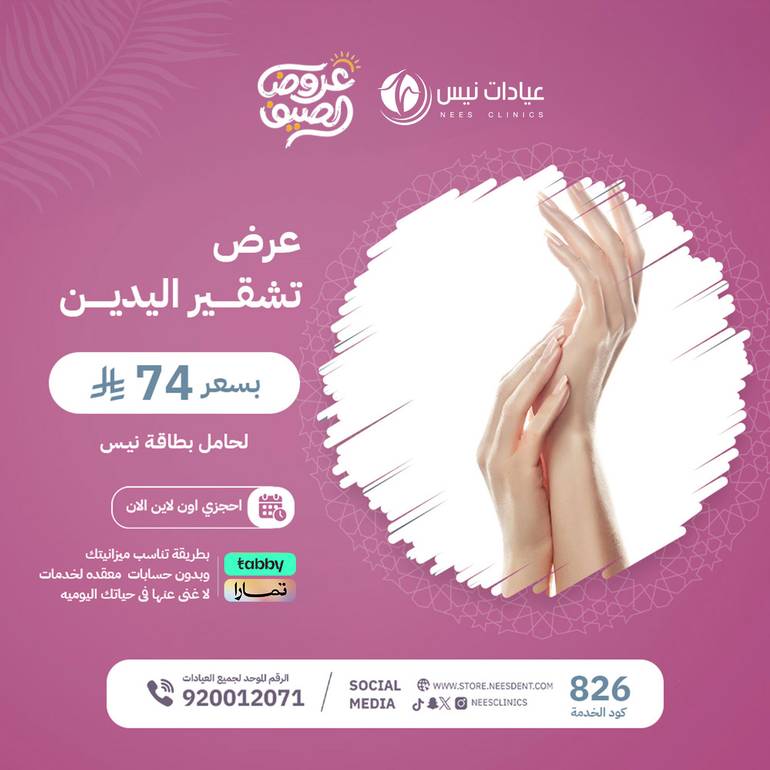 عرض تشقير يدين