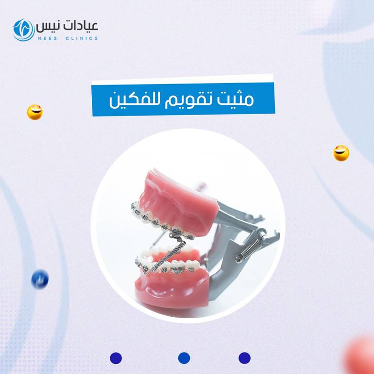 مثيت تقويم للفكين