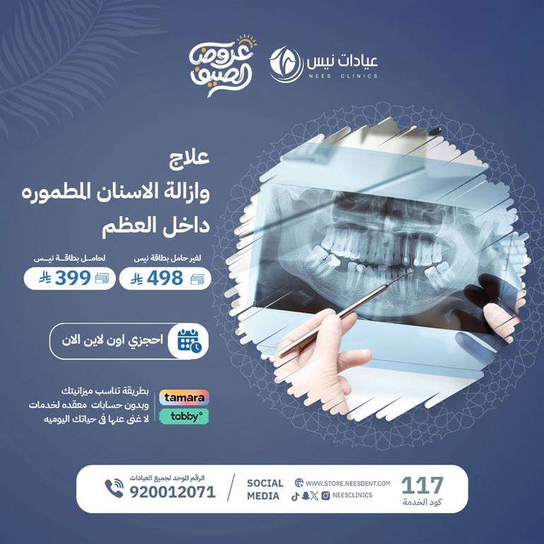 علاج وازالة  الاسنان المطموره  داخل العظم