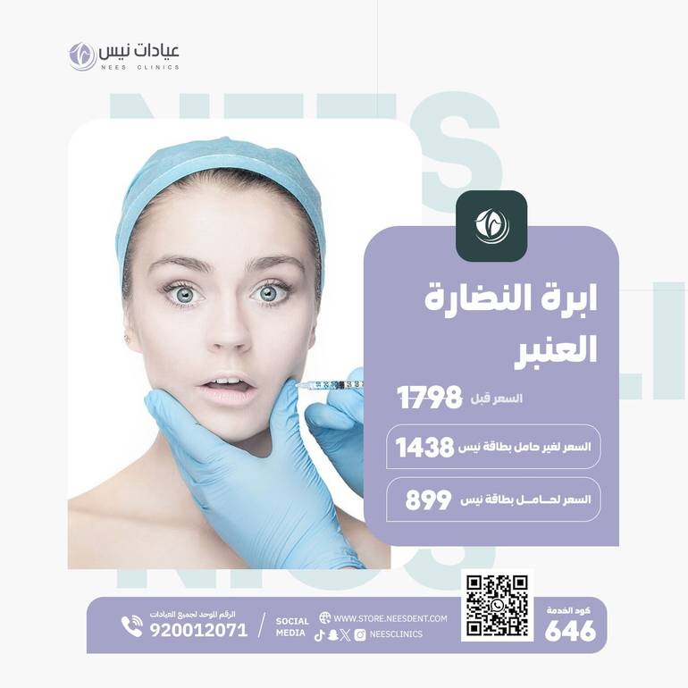 ابرة النضارة العنبر