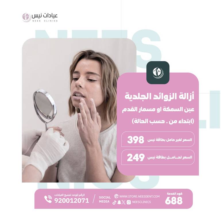 ازالة الزوائد الجلدية عين سمكة او مسمار القدم (ابتداء من حسب الحالة )