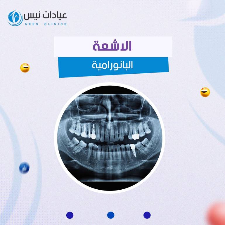  الاشعة البانورامية