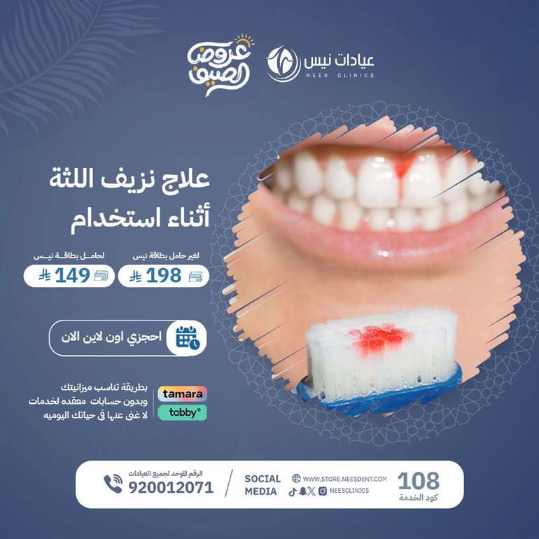 علاج نزيف  اللثه أثناء استخدام الفرشاه