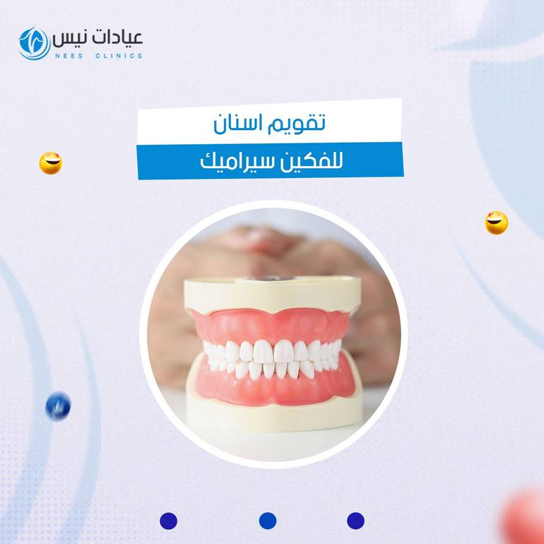 تقويم اسنان للفكين سيراميك
