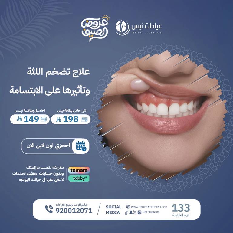 علاج  تضخم اللثه وتأثيرها على الابتسامه