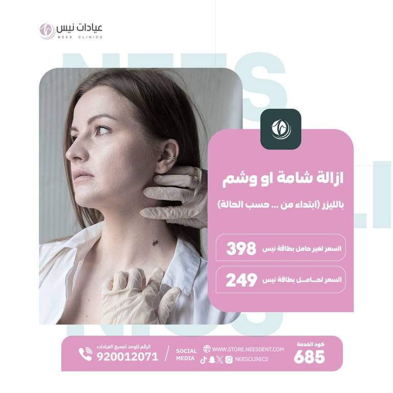ازالة شامة او وشم باليزر (ابتداء من ..حسب الحالة )