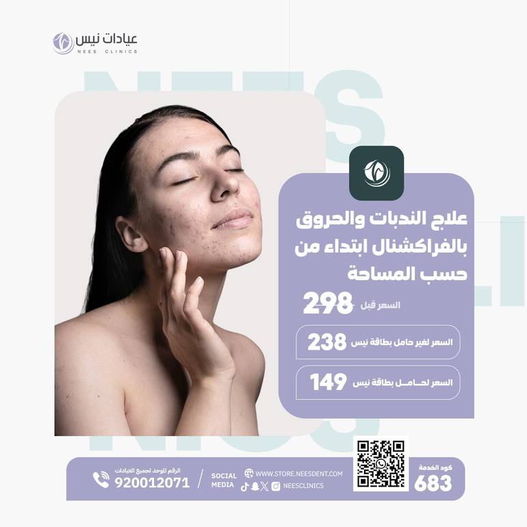 علاج الندبات والحروق بالفراكشنال (ابتداء من.... حسب المساحة)