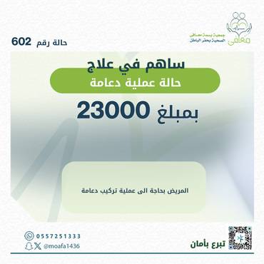عملية دعامه