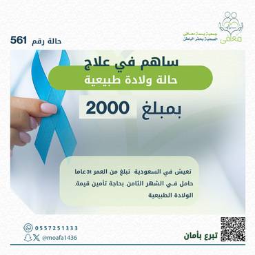حالة ولادة 