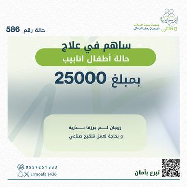أطفال انابيب