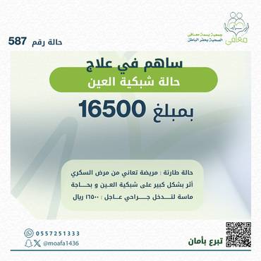 شبكية العين