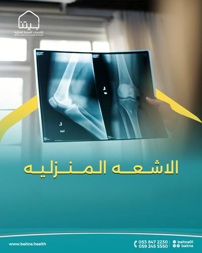 أشعة سينية (صورة إضافية)