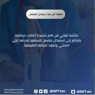 خطوة أمل بعد استبدال المفصل