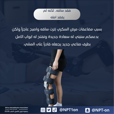 طرف صناعي لمريض سكري