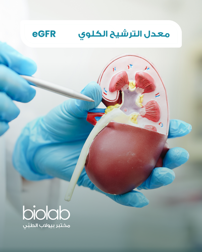 eGFR