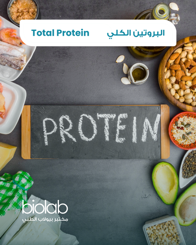 Total Protein