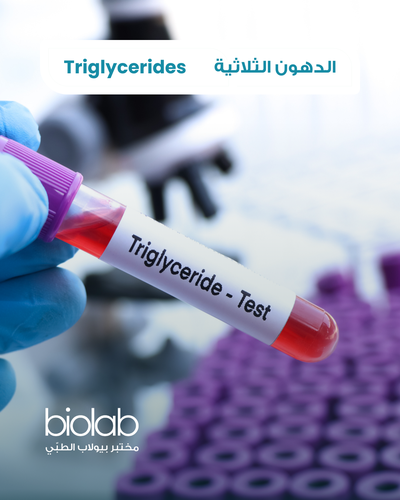 الدهون الثلاثية
