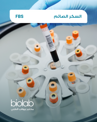 سكر الدم الصائم