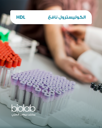 الكوليسترول غير نافع