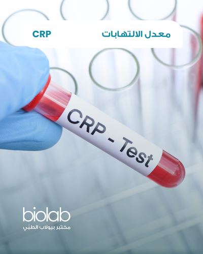 معدل الالتهابات
