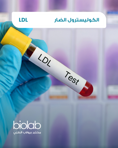 الكوليسترول النافع