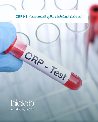البروتين المتفاعل عالي الحساسية