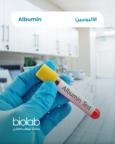 الألبومين