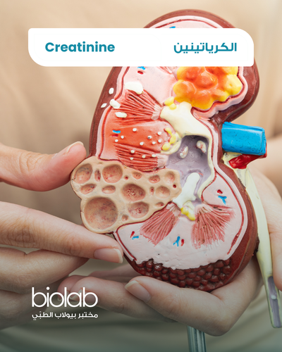 الكرياتينين