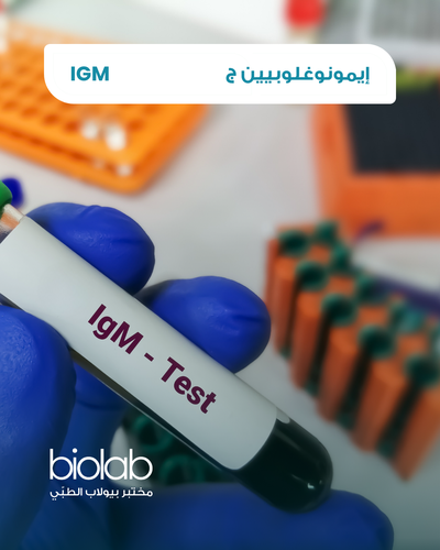 إيمونوغلوبيين ج