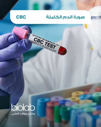 صورة الدم الكاملة