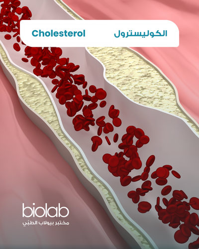 الكوليسترول