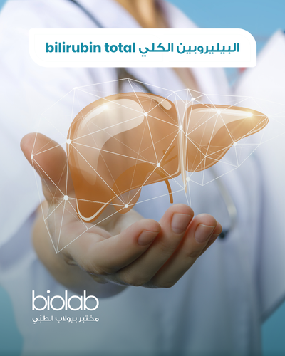 bilirubin total