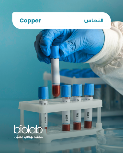 النحاس