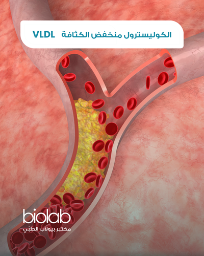 VLDL