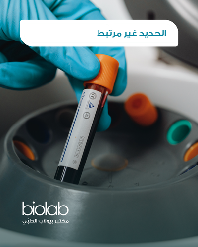 الحديد غير مرتبط