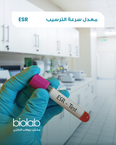 معدل سرعة الترسيب