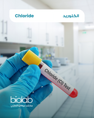 Chloride