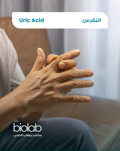 Uric Acid