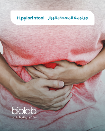 H.pylori stool