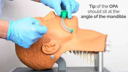  مجرى هوائي فموي (Guedel Airway)