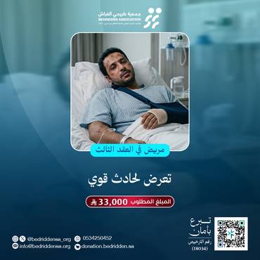 "حالة حرجة تعرض لحادث قوي"