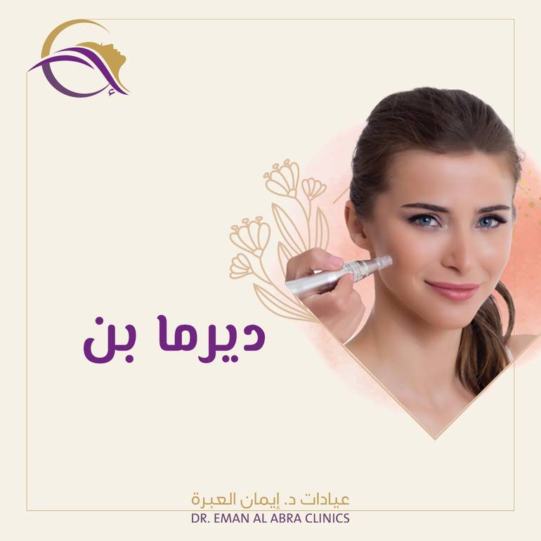 جلسة ديرمابن