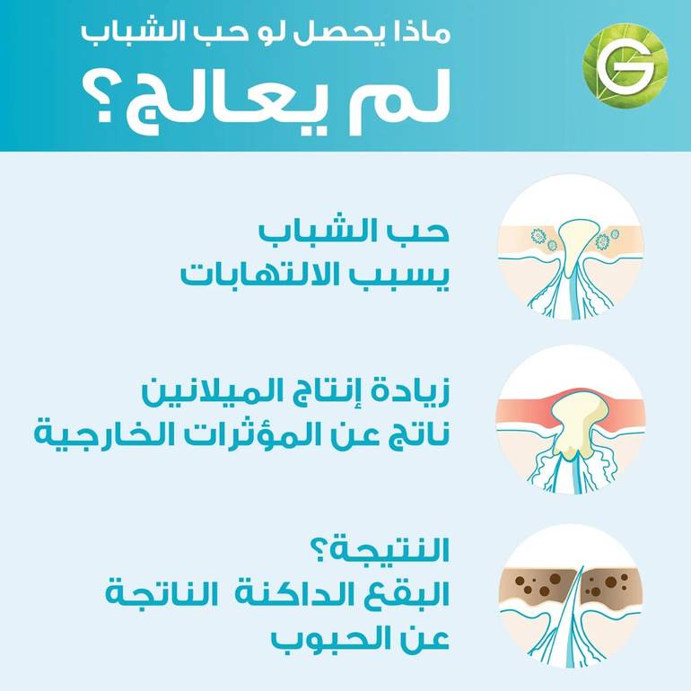 غارنييه سيروم سكين اكتيف تنقية سريعة للبشرة المعرضة لحب الشباب بحمض الساليسيلك - 30مل